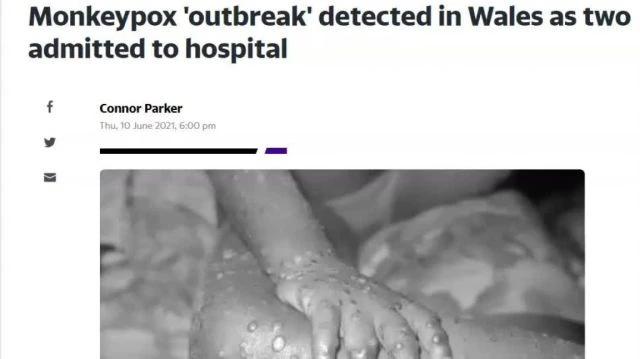 Monkey Pox in the UK