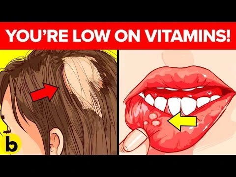 8 Warning Signs That Your Body Is Low On Essential Vitamins