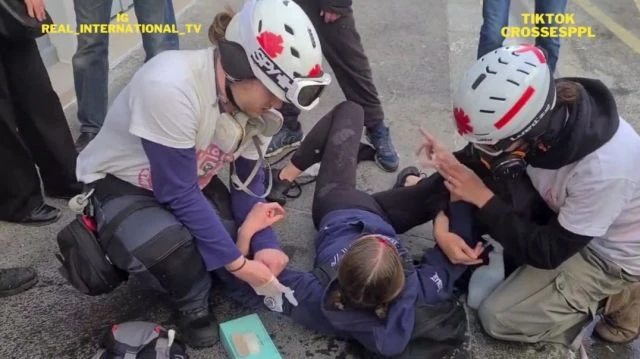 PARIS Protester seriously injured with a cracked skull