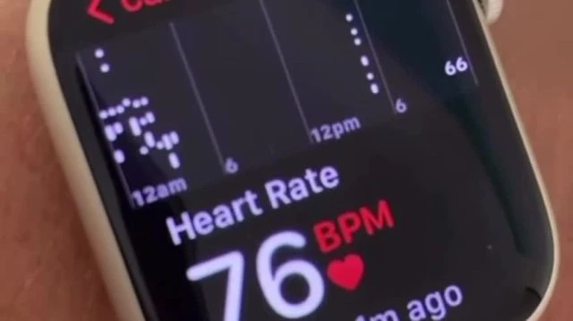 the vaccinated are reporting myocarditis around the world and filming their smart watches in horror