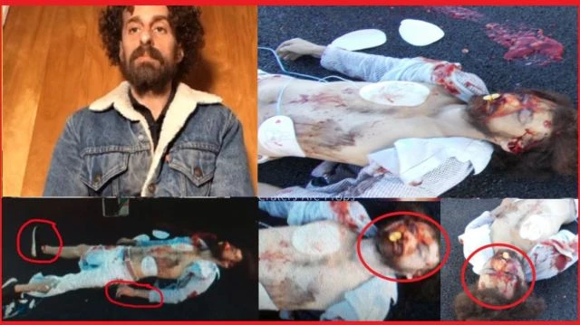 DID ISAAC KAPPY SHOOT HIMSELF IN THE EYE THEN THROW HIMSELF OFF UNDER THE BRIDGE