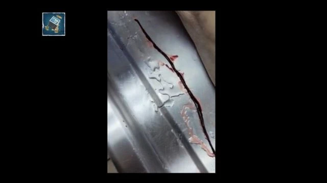 Unbelievable Blood Clot Footage Released By Embalmer Richard Hirschman