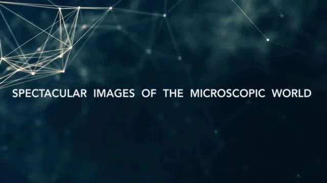 Electron Microscope Images