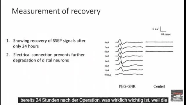 Graphen-Based Neuronal-Interface