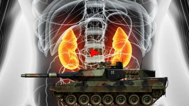 UKRAINE - Tanks for Kidneys