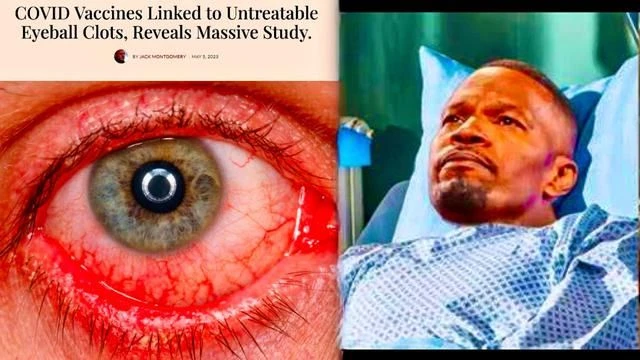 Jamie Foxx Exposes Covid Vax Linked To Untreatable Eyeball Clots Ventilators Killed Covid Patients