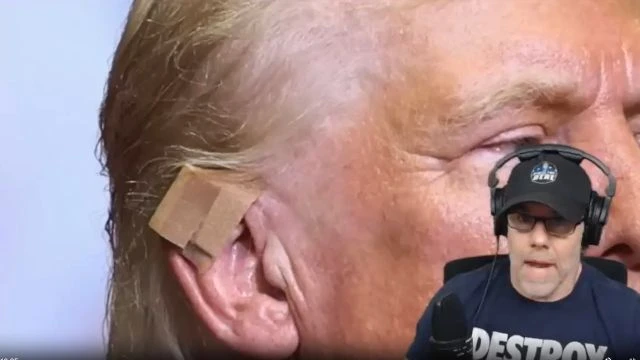 EARGATE New Trump Ear Pix Emerge - What's REALLY HAPPENING Here