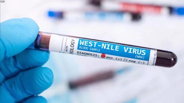 Dr Fauci's West Nile Virus - Dr Sam Bailey